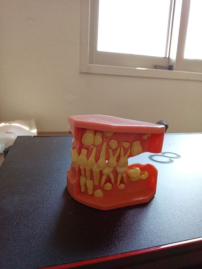 乳歯永久歯交換期模型、永久歯歯列模型