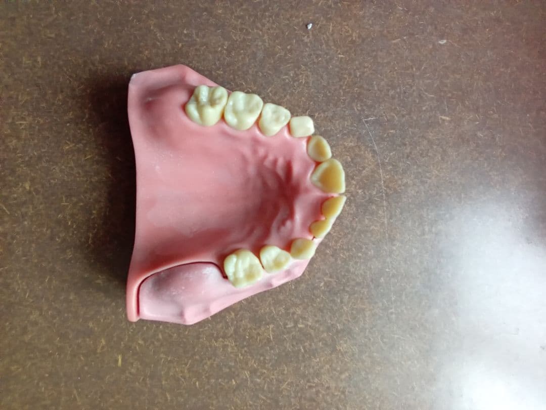 乳歯永久歯交換期模型、永久歯歯列模型