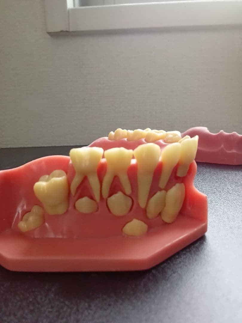 乳歯永久歯交換期模型、永久歯歯列模型