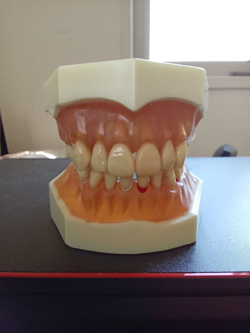 乳歯永久歯交換期模型、永久歯歯列模型