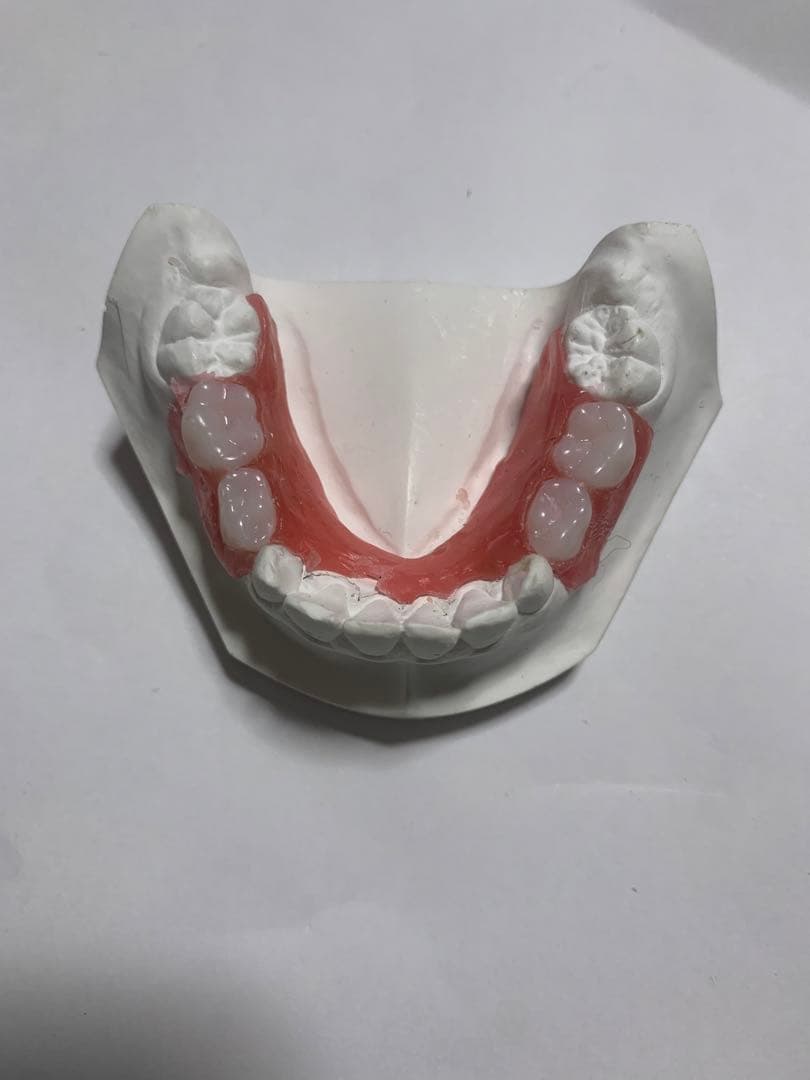 小児　入れ歯　顎模型