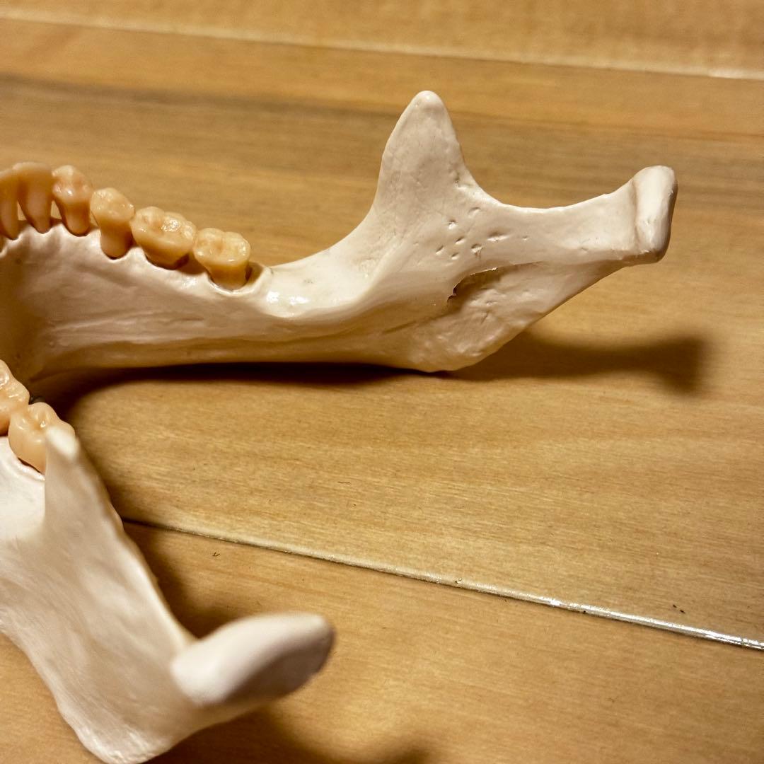 3B Scientific GmbH 頭蓋骨 模型 医学 骨標本