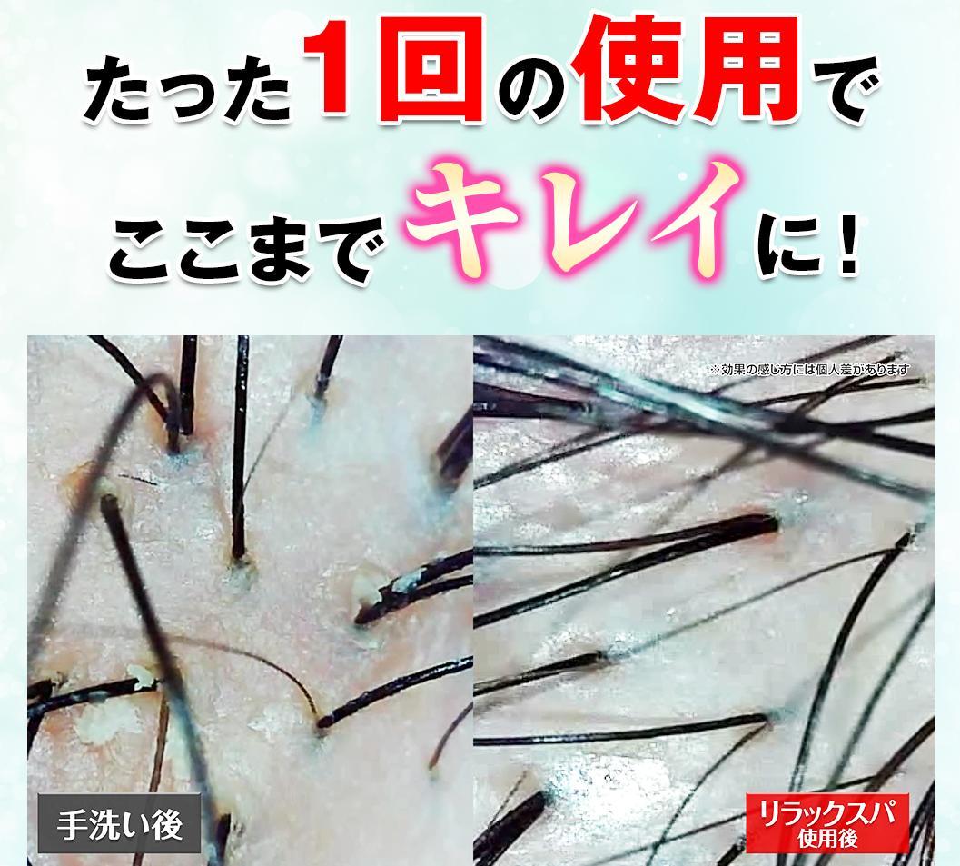 スカルプマッサージ機 ミントグリーン